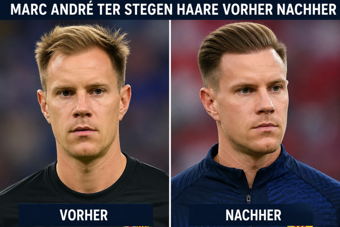 rael hoffmann vermögen marc andré ter stegen haare vorher nachher