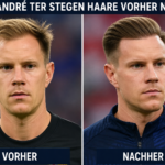 marc andré ter stegen haare vorher nachher